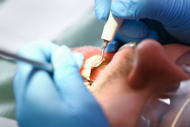 Best Broken or Cracked Tooth Emergency Dentist in Kings Mills, OH